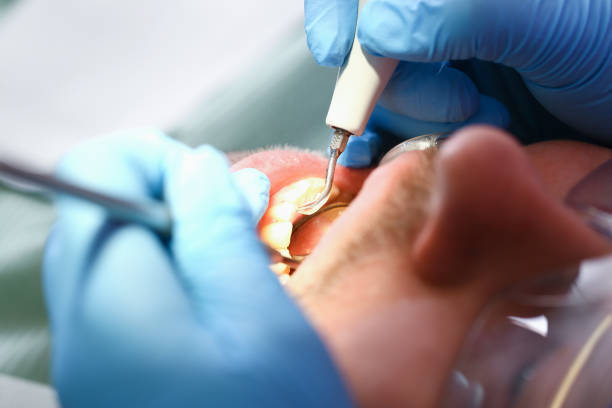 Best Emergency Denture Repair in Little Chute, WI